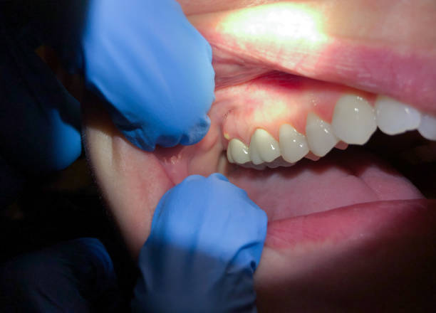 Best Emergency Treatment for Jaw Pain or Injury in Atlantis, FL